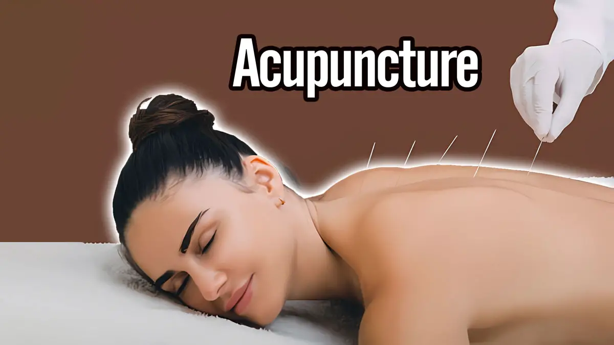 Acupuncture during pregnancy